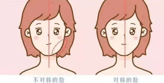 02脸不对称.jpg